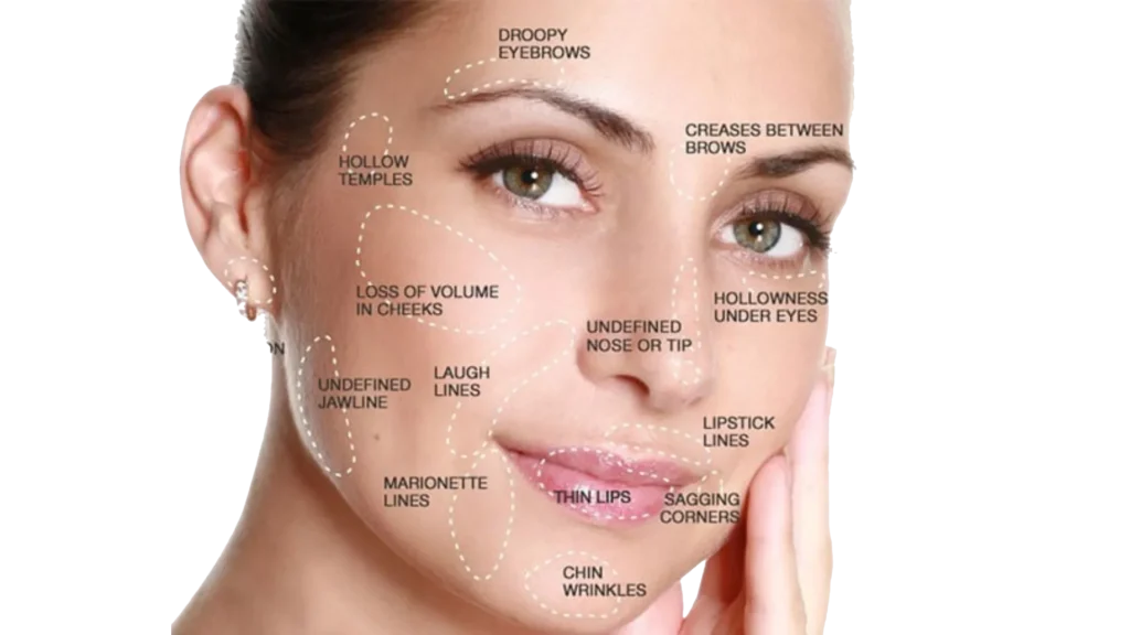 Dermal Fillers Face1 in Westfield, IN | Fine Tuning Health