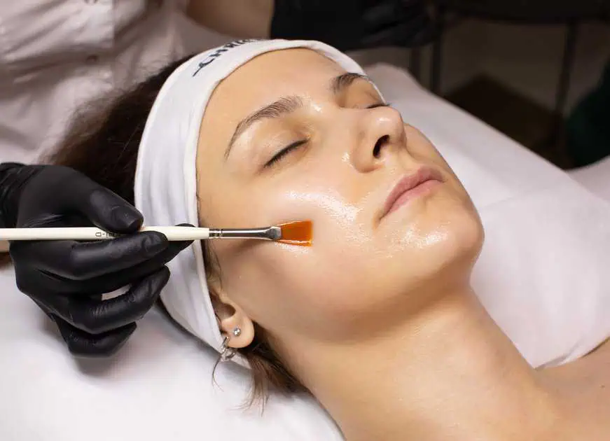 Chemical Peels Treatment in Westfield, IN by Fine Tuning Medical Wellness Center